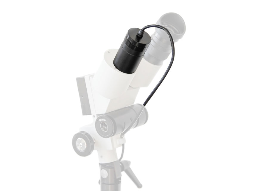 camera digitala colposcope usb